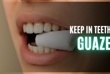 How Long to Keep Gauze in After Tooth Extraction