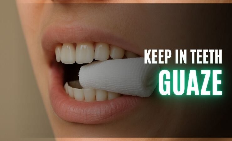 How Long to Keep Gauze in After Tooth Extraction